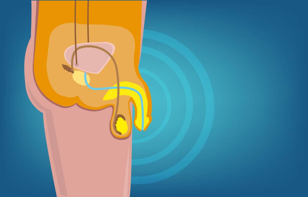 COVID 19 And Erectile Dysfunction What Do Recent Studies Reveal