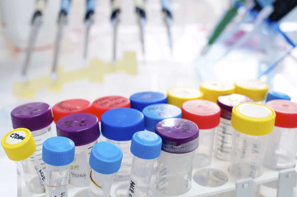 Promoting A Healthier Community The Essential Role Of Drug Screening