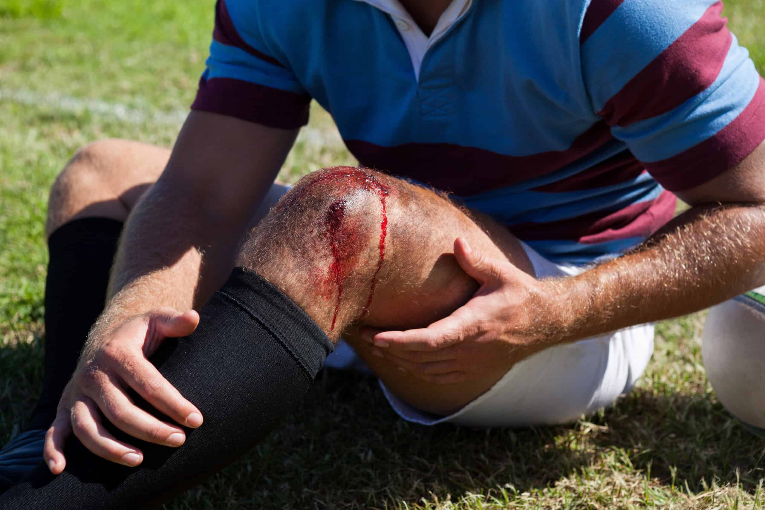 mid section of rugby player with injured knee 2025 04 03 12 28 06 utc scaled