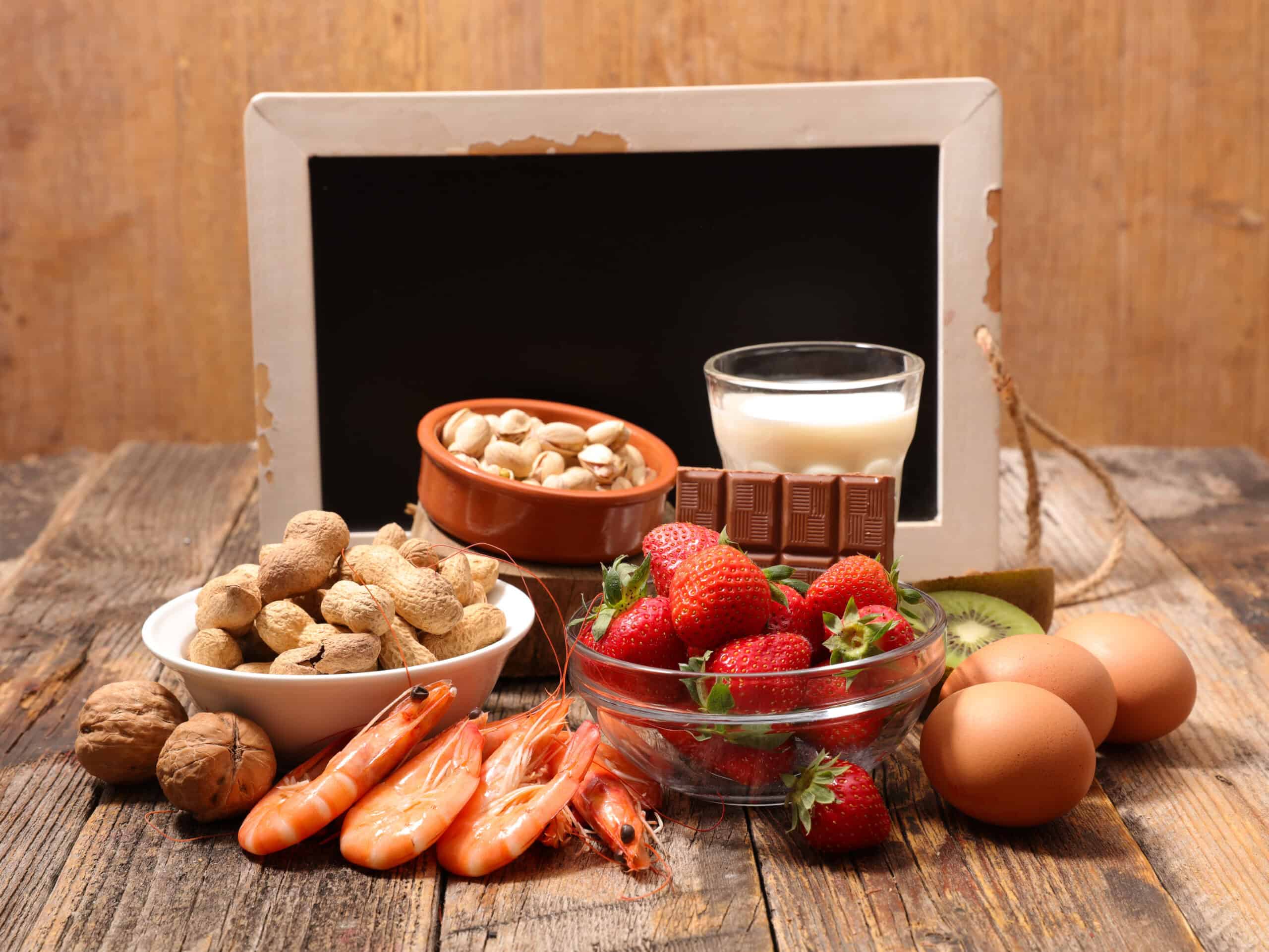 How Urgent Care Helps With Food Allergies and Mild Reactions